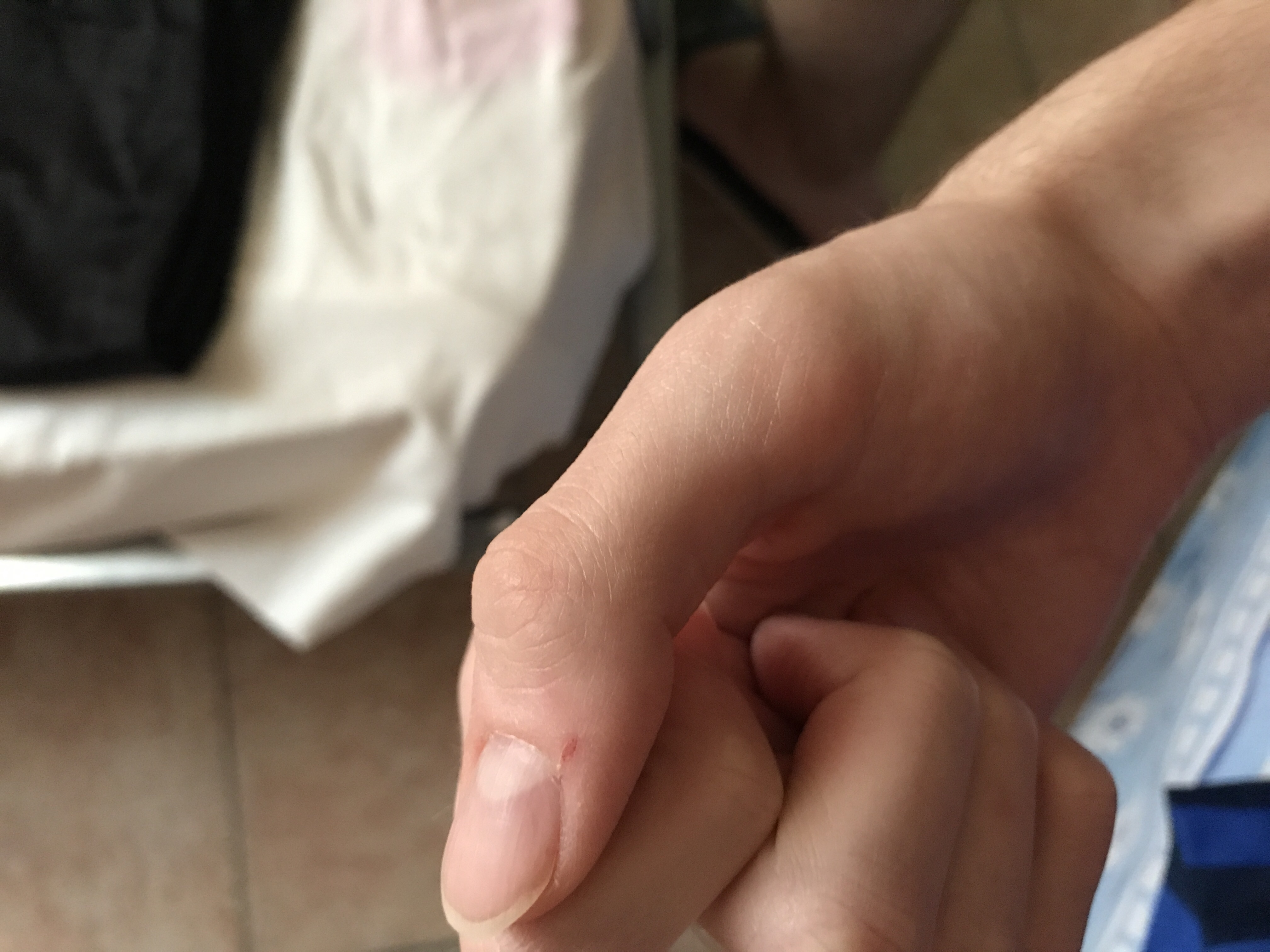 Ist Meine Angst Vor Tetanus Berechtigt Medizin Impfung
