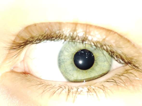 Ist meine Augenfarbe hübsch oder besonders?