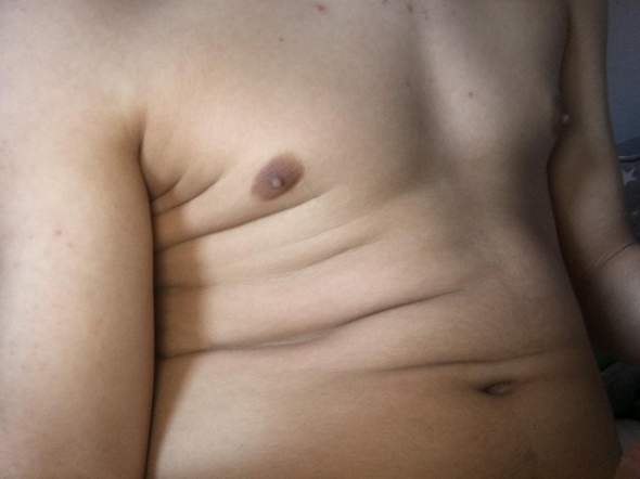 Die größer andere brust mann eine als Kosmetische Chirurgie: