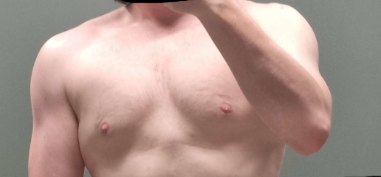 Ist meine Brust so genetisch bedingt oder lässt sich da noch was machen durch trainieren?