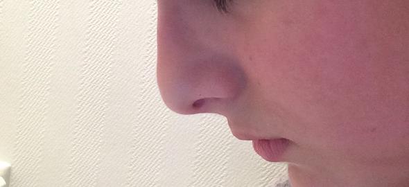 Ist Meine Nase Hasslich Meinung