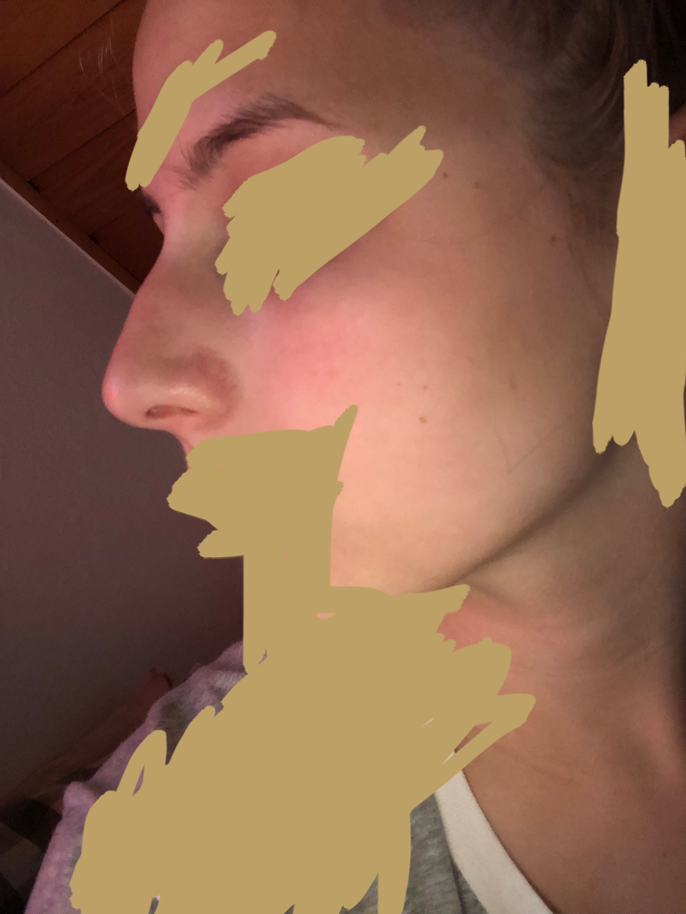 ich fasse an meine nase