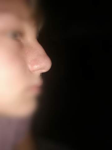 Ist Meine Nase Wirklich Zu Gross Und Hasslich Aussehen Schonheit Gesicht