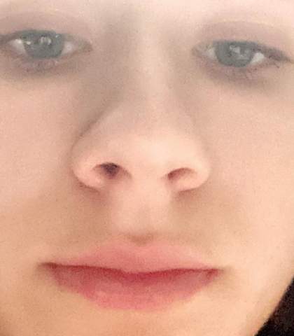 Ist Meine Nase Zu Gross Oder Von Der Seite Zu Lang Was Sagt Ihr Soll Ich Sie Mal Operieren Lassen Schonheits Op