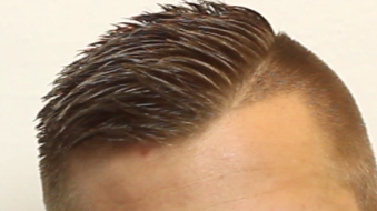 undercut haarschnitt