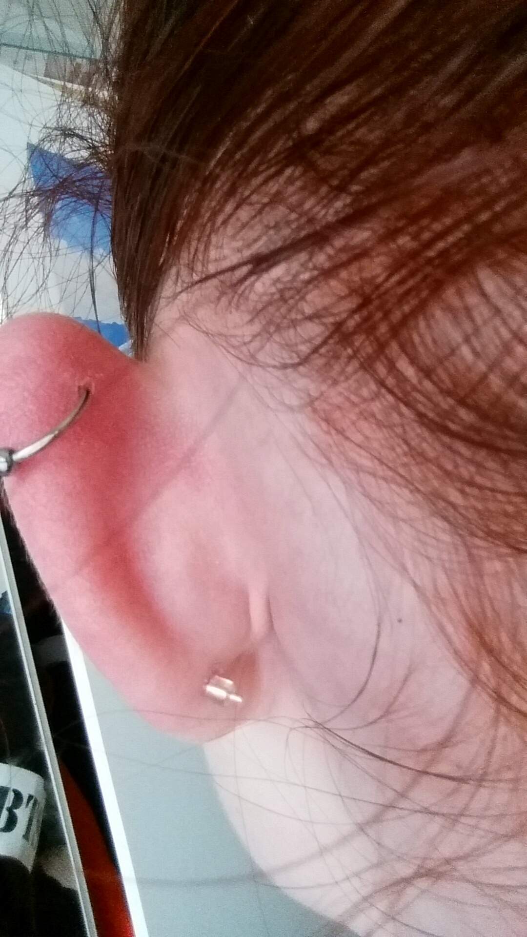 Ist mit meinem Piercing alles normal? (helix piercing)
