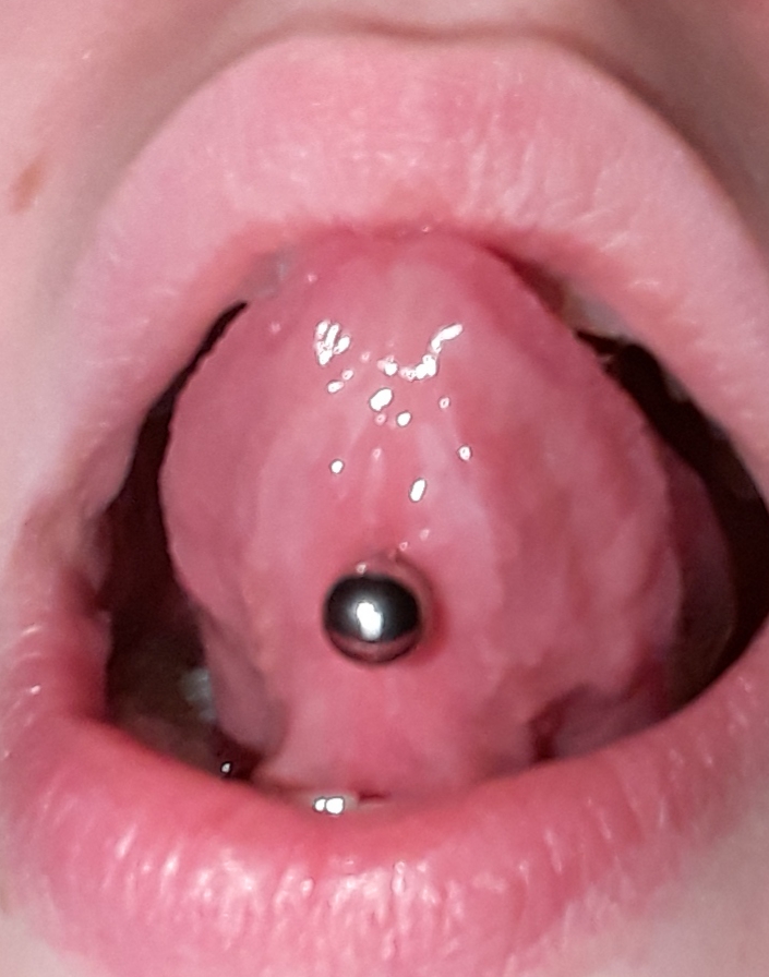 Zungen Piercing