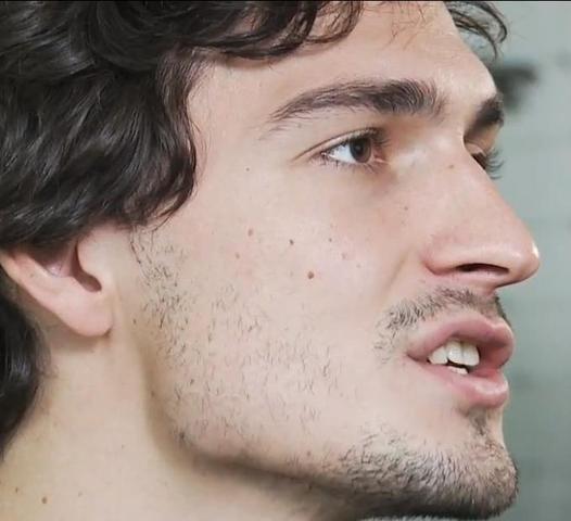 Ist So Ein Bart Ok Oder Schlecht Haare