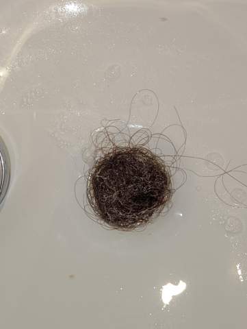 Ist so viel Haare beim Duschen verlieren normal?