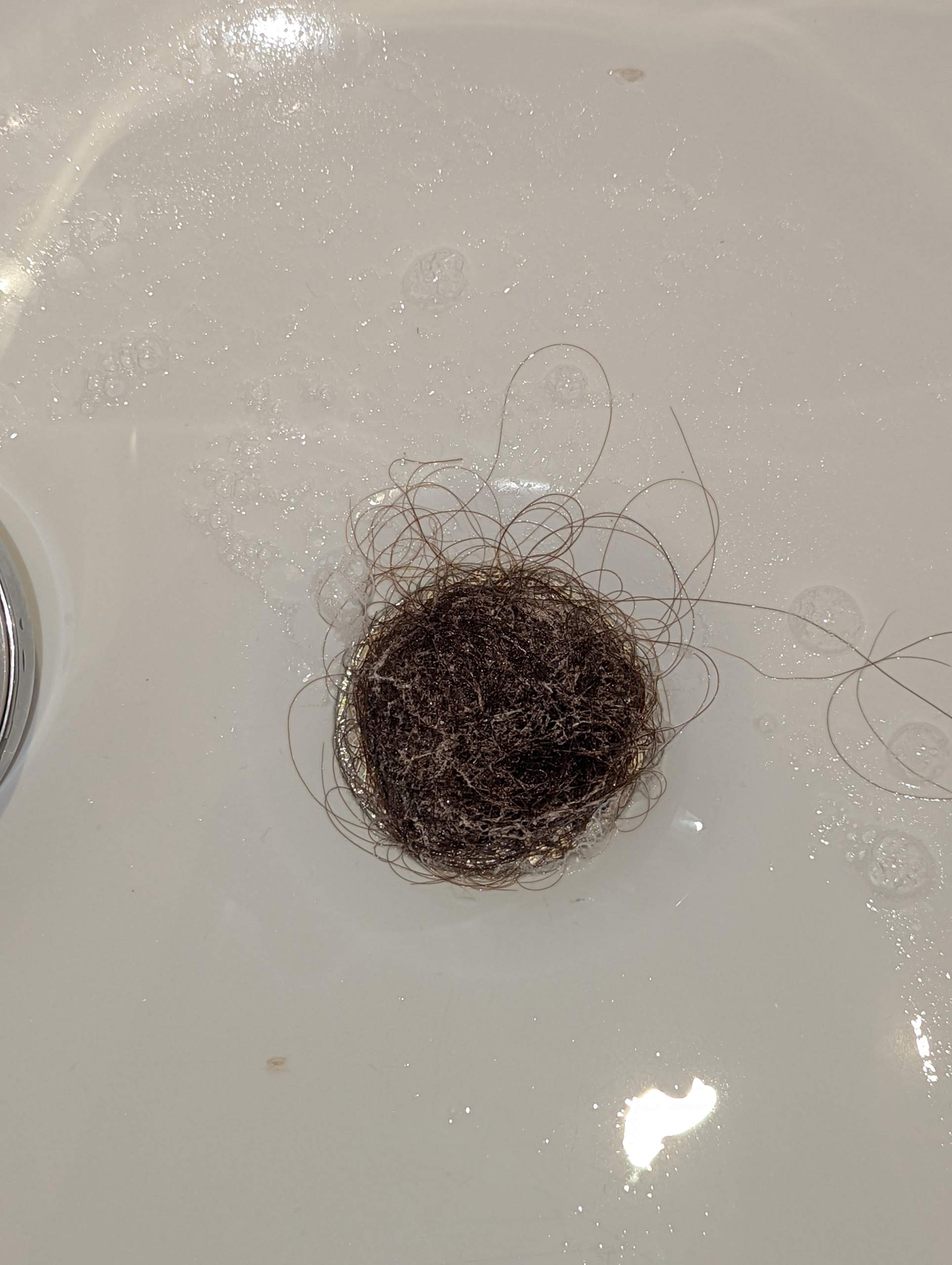 Wie Viel Haare Am Tag Verlieren Ist Normal