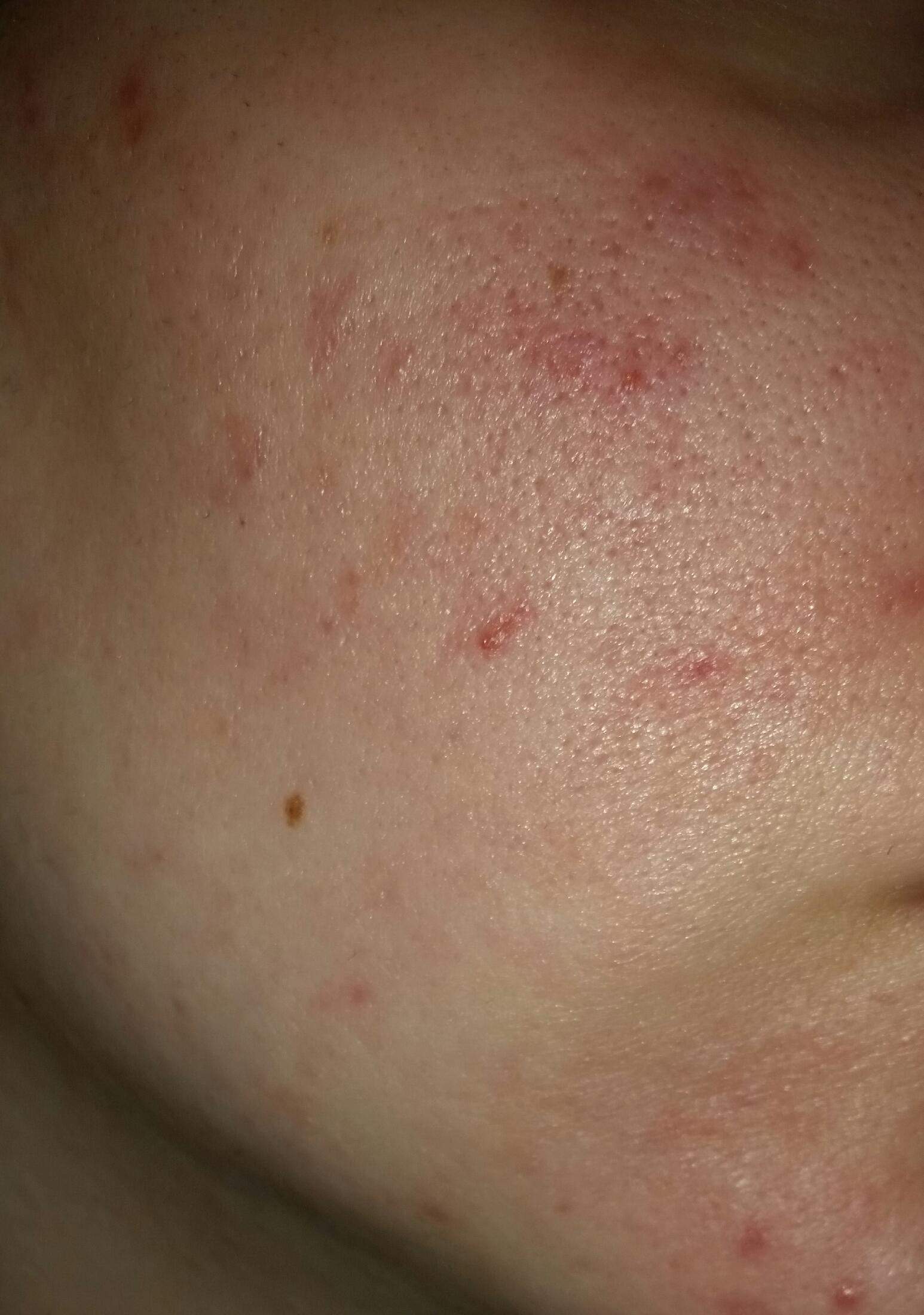 Stärken Leiter Berechtigungsnachweis skid 50 mg tabletten nebenwirkungen entfernen Element passen