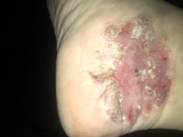 - (Gesundheit und Medizin, Arzt, Dermatologie)