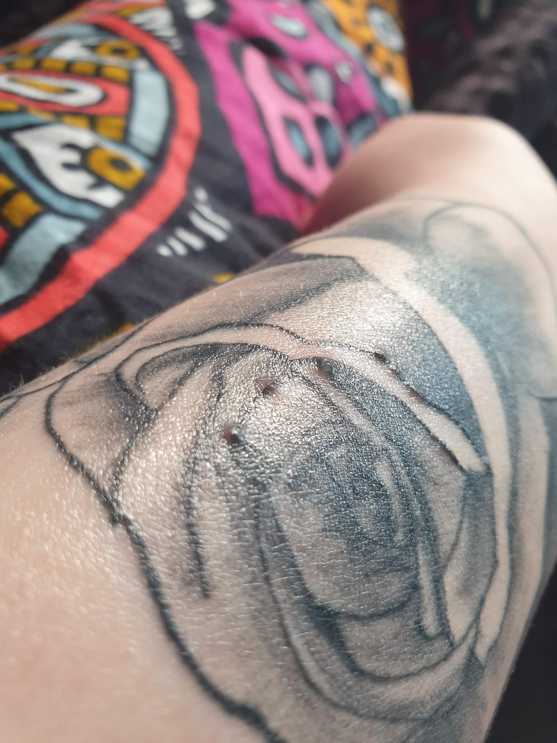 Juckende kleine Pickel auf Tattoo?