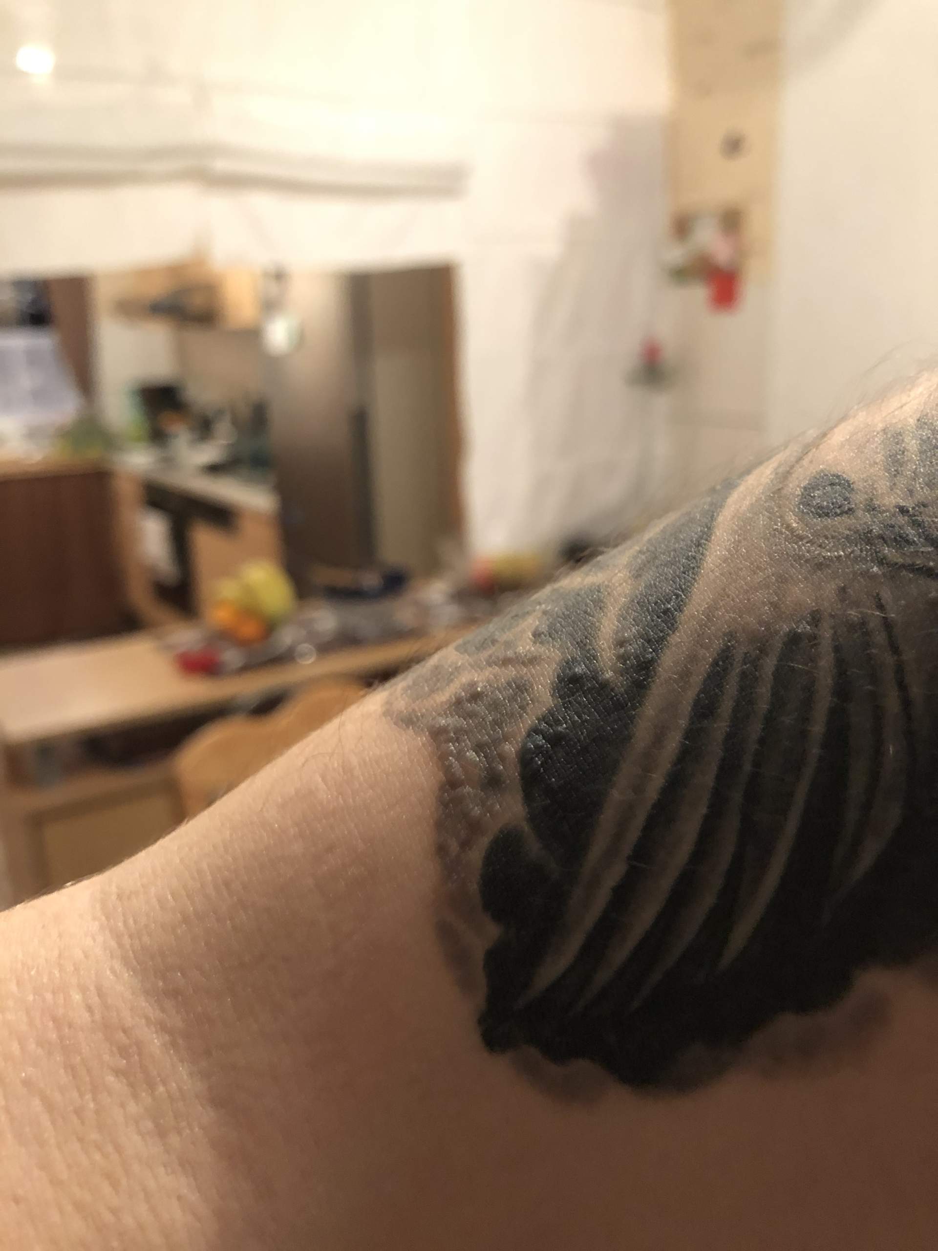 Juckende Pusteln auf Tattoo nach einem Jahr? (Allergie, Ausschlag, jucken)