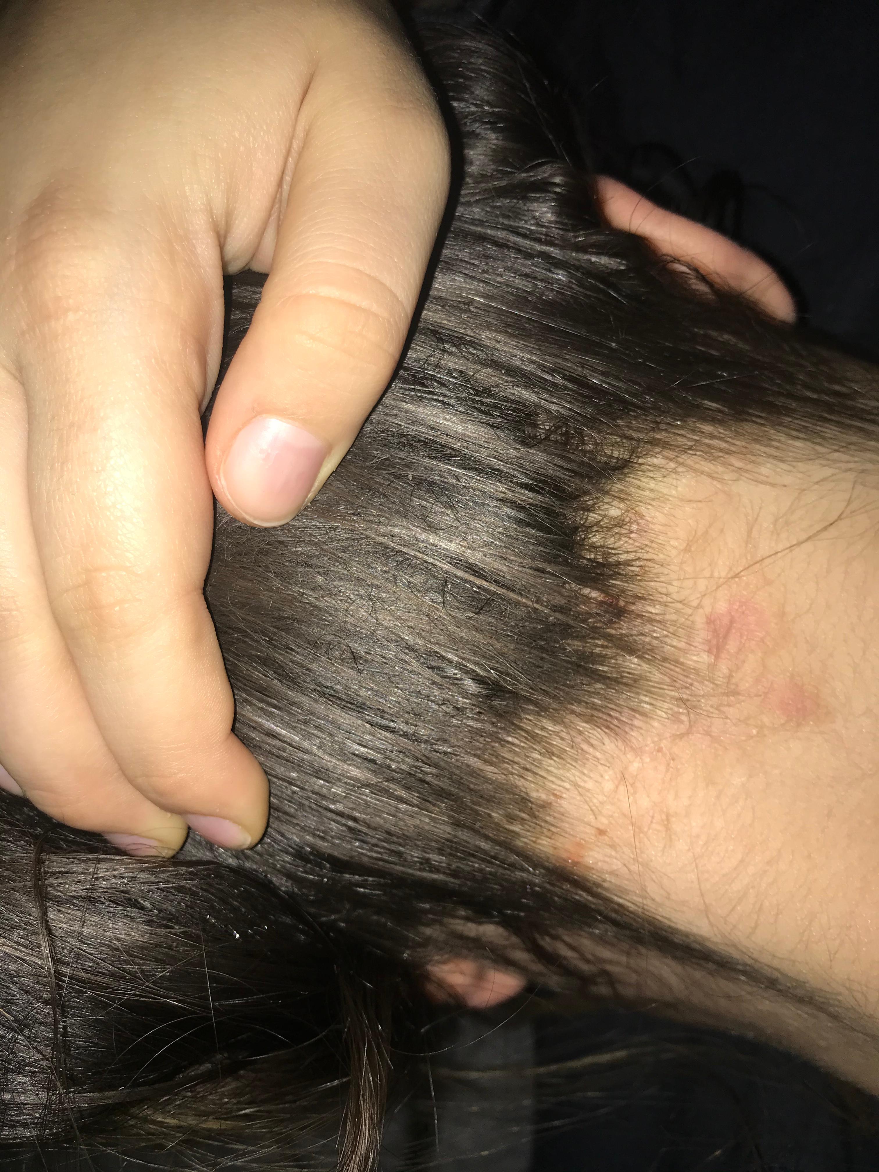 Juckende Stellen Am Hinterkopf Nacken Gesundheit Und Medizin Juckreiz Juckende Stellen Am Hinterkopf Nacken Gesundheit Und Medizin Juckreiz