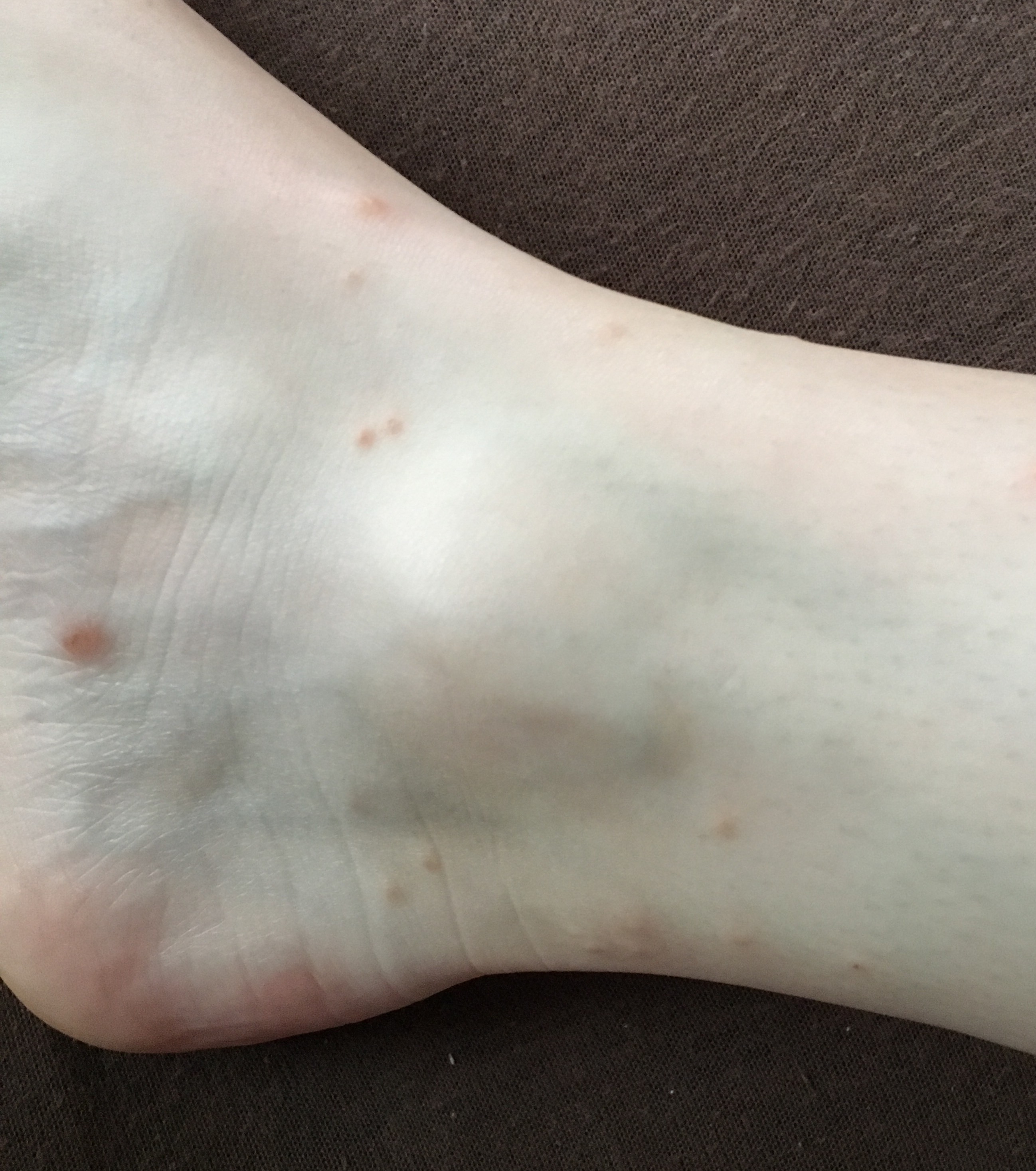juckender Ausschlag am ganzen Körper? Was soll ich tun? Was ist das? (Gesundheit, Krankheit, Haut) juckender Ausschlag am ganzen Körper? Was soll ich tun? Was ist das? (Gesundheit, Krankheit, Haut)