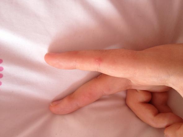 Hände - (Gesundheit, Füße, Hand)