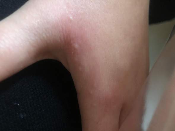 Was Tun Gegen Jucken Am Ganzen Korper Was Tun Gegen Jucken Am Ganzen Korper