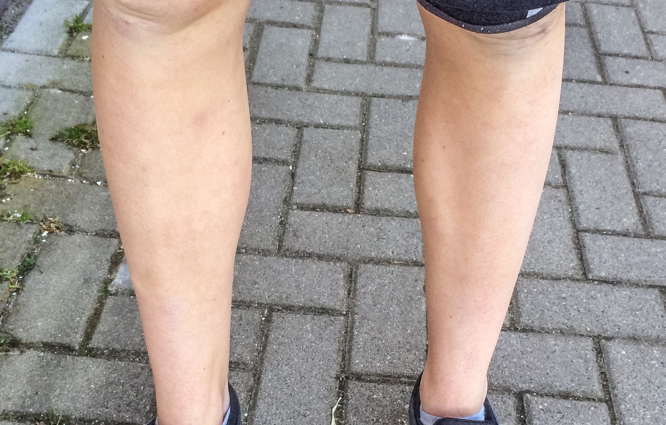 Junge 16 Mit Rasierten Beinen Beine Korperpflege