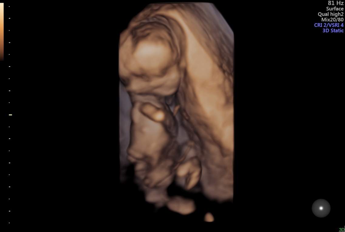 Ob8wvqaae0ikim Ob8wvqaae0ikim