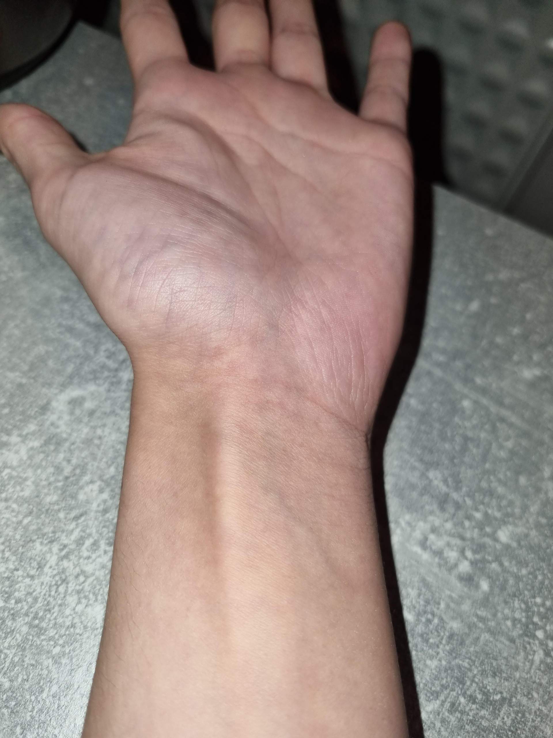 Kalt oder warmer Hauttyp? (Frauen, Haut, Schönheit)