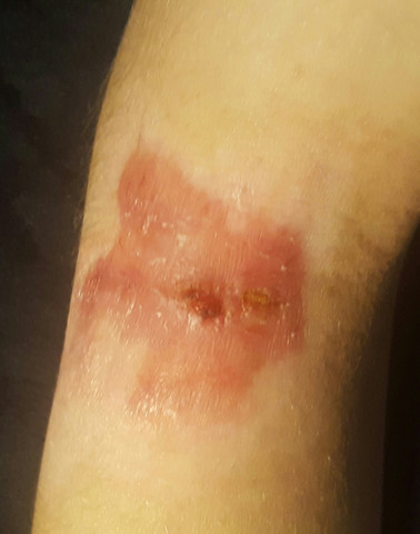 So sieht das aus - (Gesundheit, Medizin, Körper)
