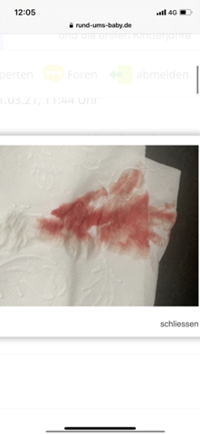 Kann Das Eine Einnistungsblutung Sein Schwangerschaft Kann Das Eine Einnistungsblutung Sein Schwangerschaft