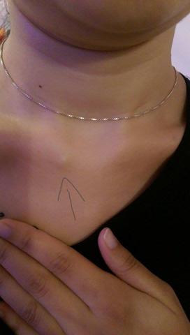 Kann Das Schlusselbein Wieder Gebrochen Sein Gleiche Symptome Wie Vor Einem Jahr Schmerzen Schlusselbeinbruch Kann Das Schlusselbein Wieder Gebrochen Sein Gleiche Symptome Wie Vor Einem Jahr Schmerzen Schlusselbeinbruch