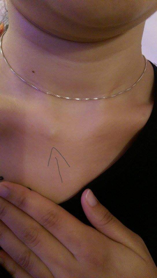 Kann das Schlüsselbein wieder gebrochen sein? Gleiche Symptome wie Vor einem Jahr. (Schmerzen Kann das Schlüsselbein wieder gebrochen sein? Gleiche Symptome wie Vor einem Jahr. (Schmerzen