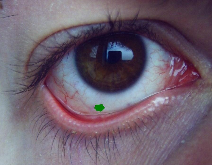 Richtige antwort Richtige antwort