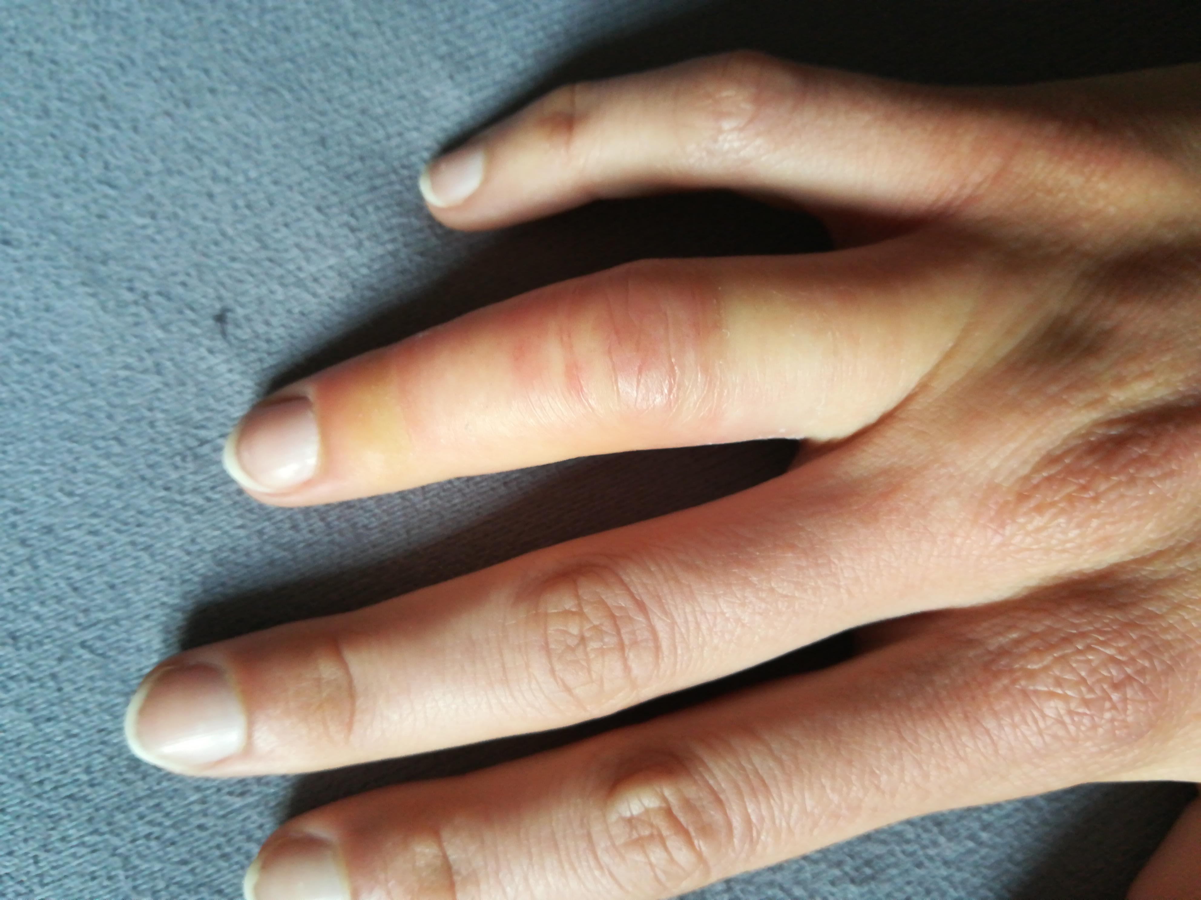 Schach spielen Spanne Friseur geschwollener finger ring Stout Gesundes Essen Umweltfreundlich