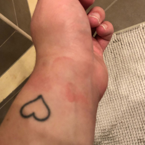 Das ist mein habdgelenk - (Arzt, Haut, Hand)