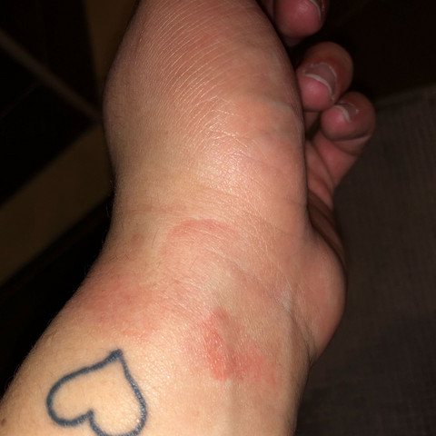 Ich meine das rote - (Arzt, Haut, Hand)