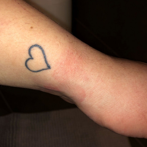 Ich weiss ned was dasbist - (Arzt, Haut, Hand)
