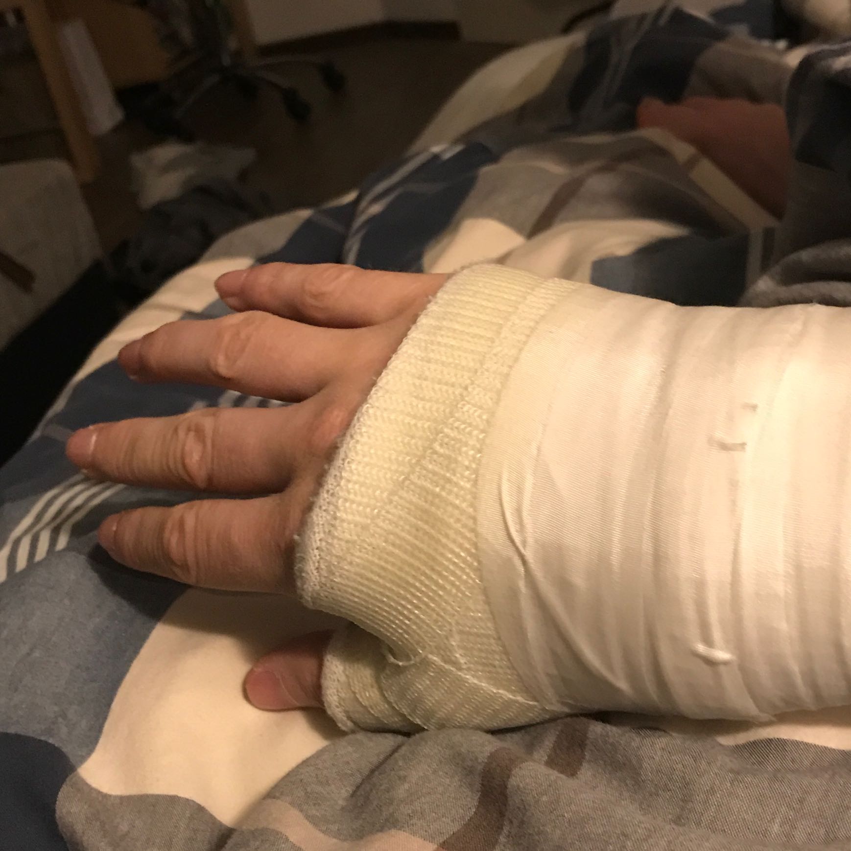 Kann Es Sein Das Mein Knochen Trotz Schraube Und Gips Nicht Richtig Zusammen Wachst Gesundheit Und Medizin Arzt Hand Kann Es Sein Das Mein Knochen Trotz Schraube Und Gips Nicht Richtig Zusammen Wachst Gesundheit Und Medizin Arzt Hand