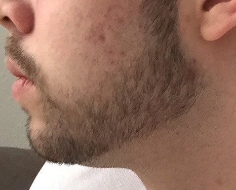 kann ich den bart so lassen bartwuchs