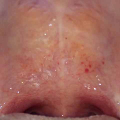 Kann ich in die Schule? (rot, Hals, Punkte)