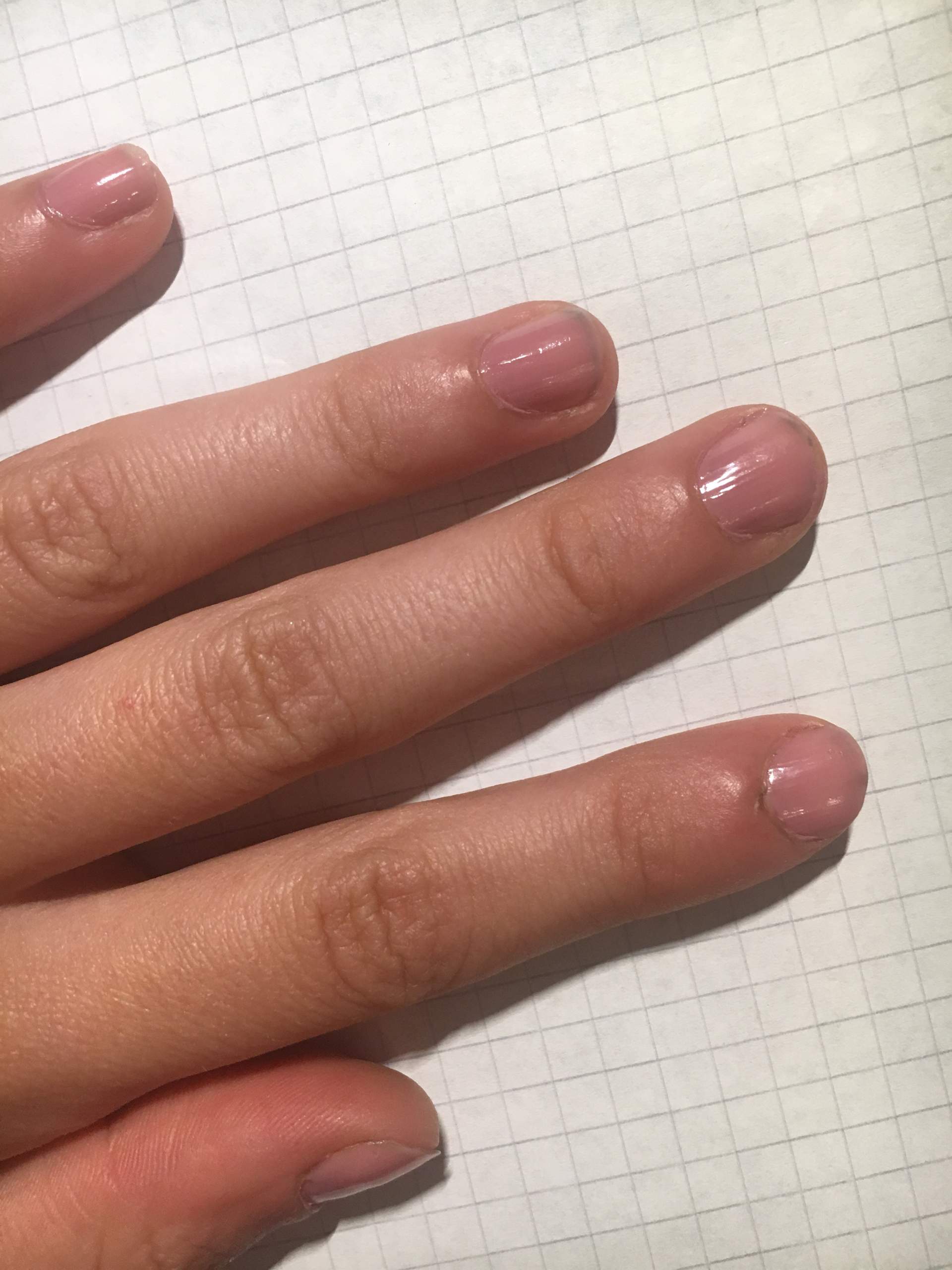 Kann ich meine Nagelbett verlÀngern? (NÀgel)