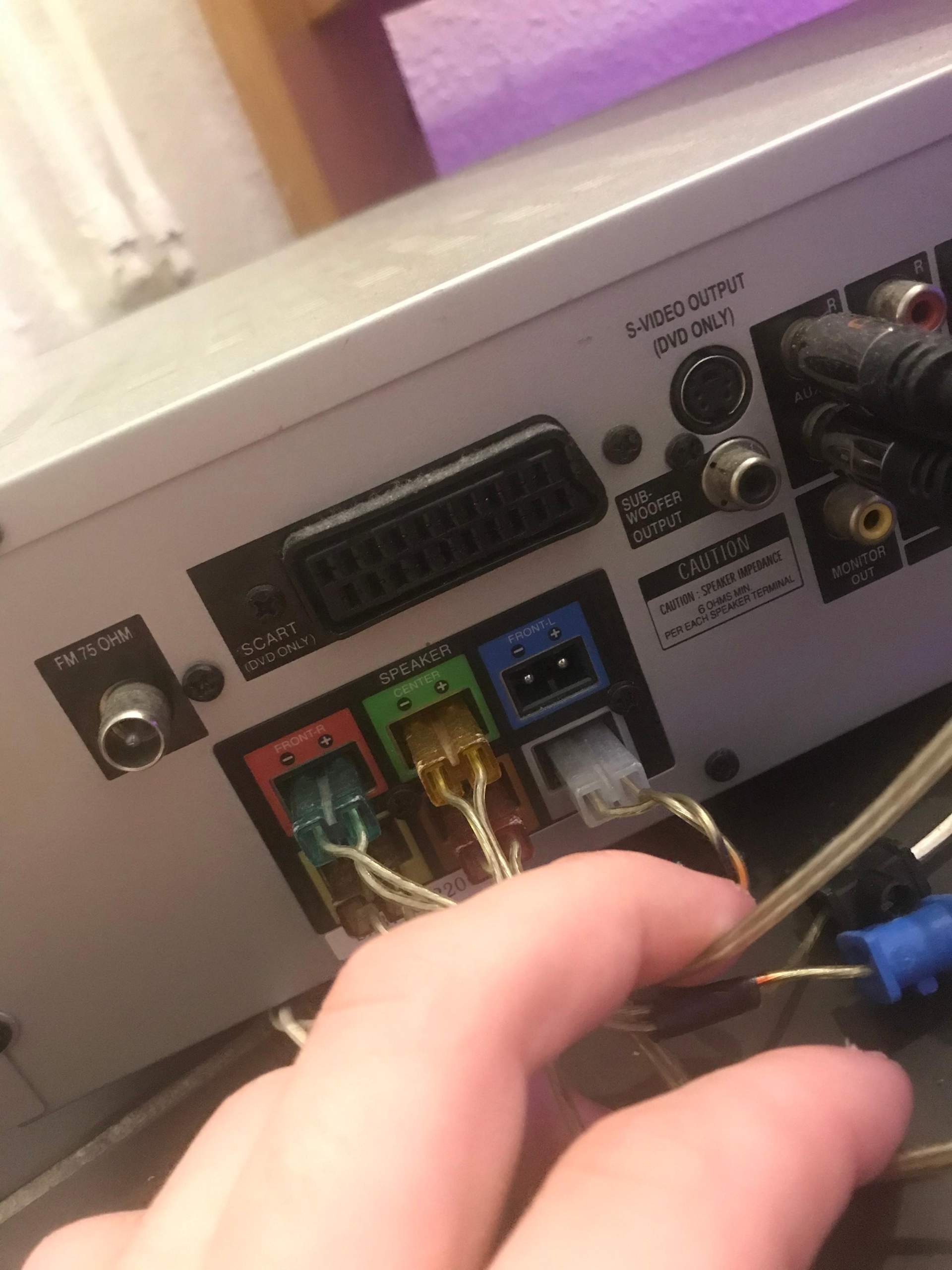 Kann ich meinen Fernseher an die 5.1 Anlage anschließen per Scart? (Computer, Technik, Technologie)