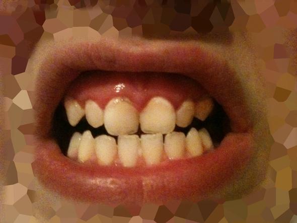 zähne - (Gesundheit, Menschen, Medizin)