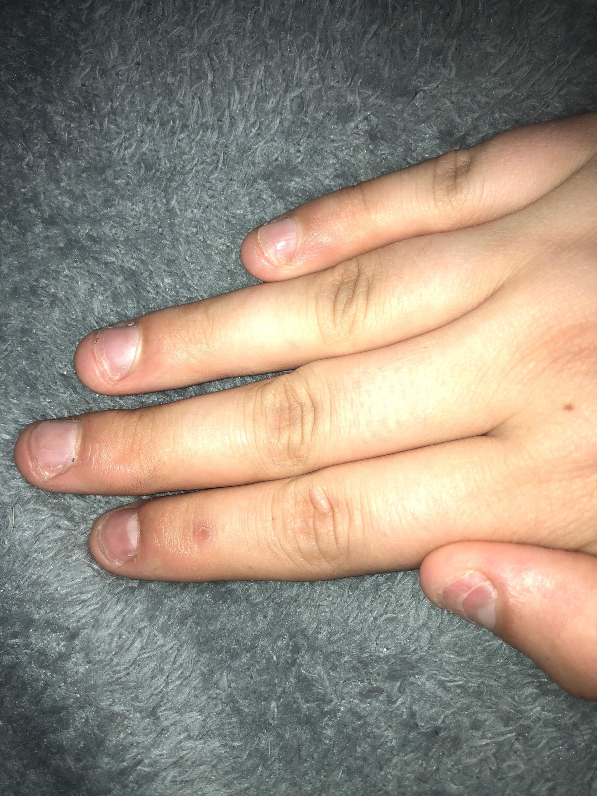 Kann ich mir mit Kurzen Nägeln, Gelnägel machen? (Beauty, Fingernägel)