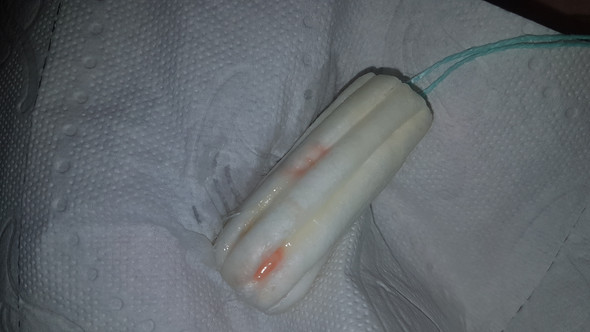 Kann Ich Schwanger Sein Nidationsblutung Gesundheit Und Medizin Sex Schwangerschaft Kann Ich Schwanger Sein Nidationsblutung Gesundheit Und Medizin Sex Schwangerschaft