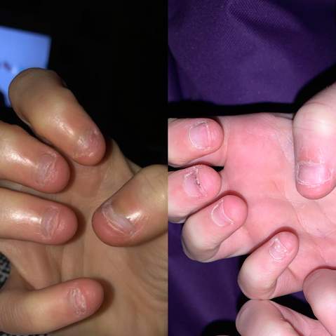 Kann Ich So Ins Nagelstudio Fingernagel