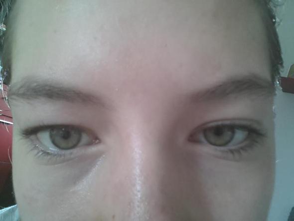 DAS AUF GOOGLE GEFUNDENE BILD! - Bitte genau die Lieder betrachten .. - (Augen, Augenlid, Lid)