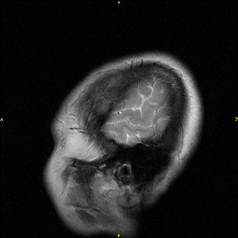 Kann jemand ein MRT auswerten? (Ohr, Schädel) Kann jemand ein MRT auswerten? (Ohr, Schädel)