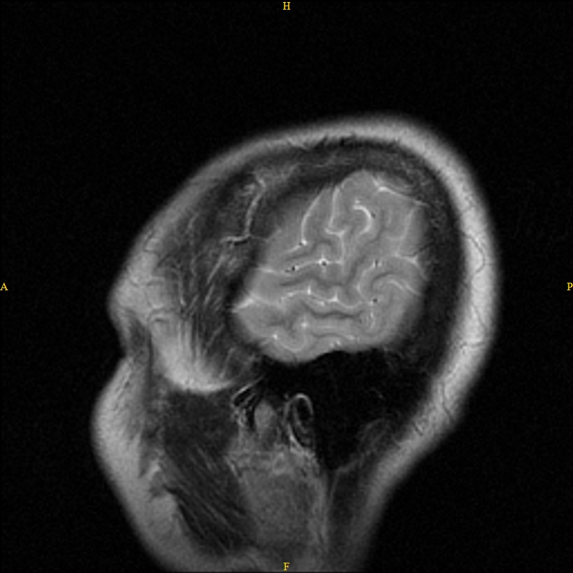 Kann jemand ein MRT auswerten? (Ohr, Schädel) Kann jemand ein MRT auswerten? (Ohr, Schädel)