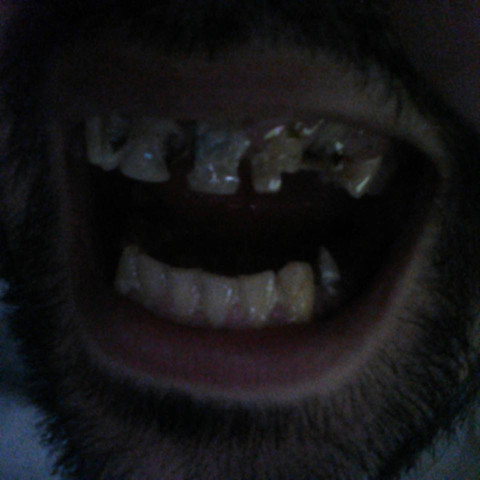 Foto - (Gesundheit, Angst, Zähne)