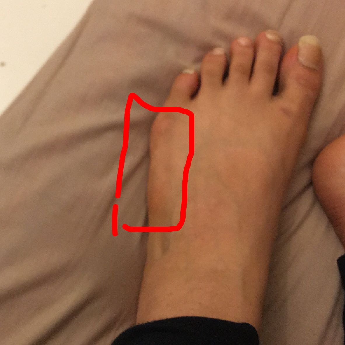 Kann Man Breite Fusse Irgendwie Schmaler Kriegen Frauen Mode Sport Und Fitness