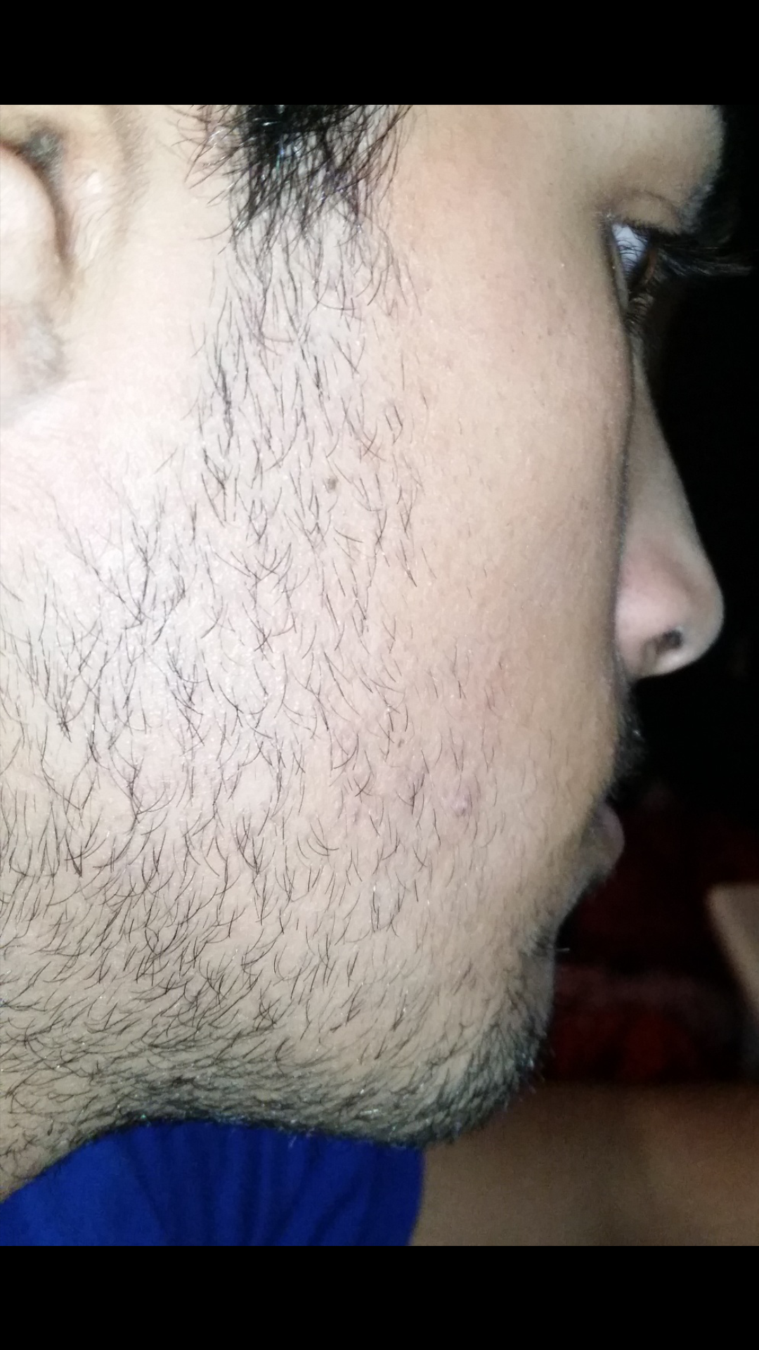 haare dicker und voller