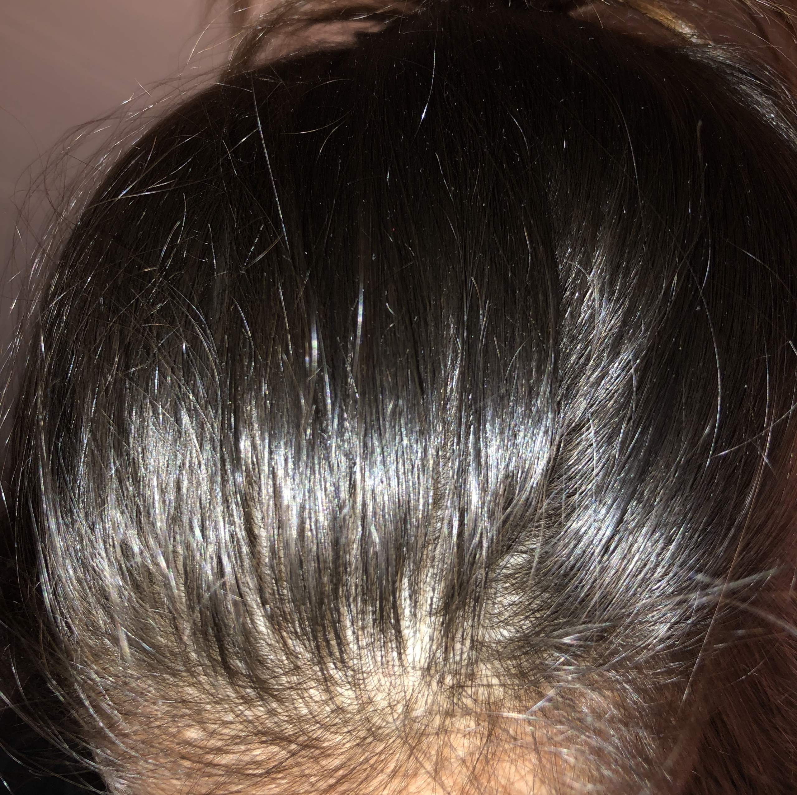 Kann man hier Läuse erkennen? (Kindertagesstätte)